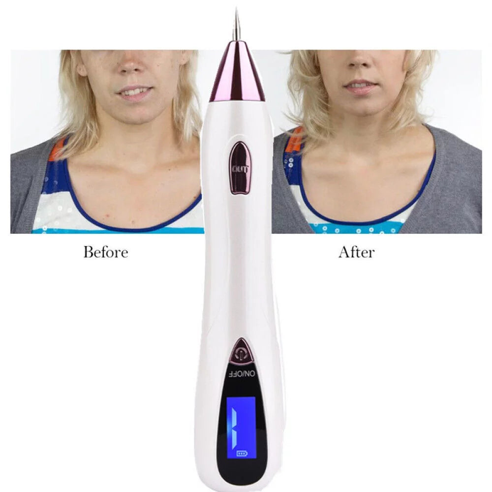 Laser Pointer for Skin Removal F904353