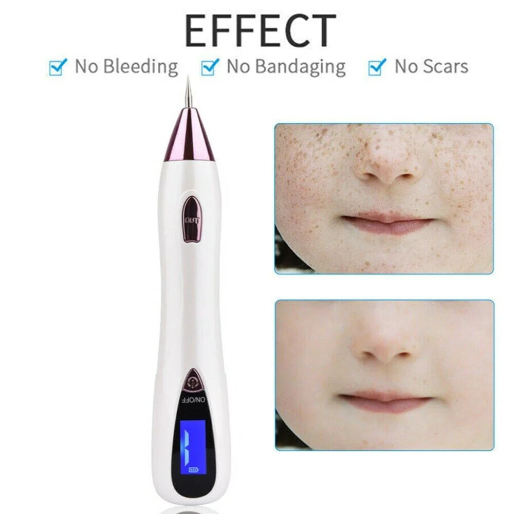 Laser Pointer for Skin Removal F904353